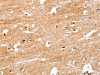 The image on the left is immunohistochemistry of paraffin-embedded Human brain tissue using CSB-PA074357 (S100B Antibody) at dilution 1/50, on the right is treated with synthetic peptide. (Original magnification: ×200)