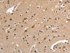 The image on the left is immunohistochemistry of paraffin-embedded Human brain tissue using CSB-PA245088 (DEFA5 Antibody) at dilution 1/15, on the right is treated with synthetic peptide. (Original magnification: ×200)