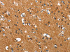 The image on the left is immunohistochemistry of paraffin-embedded Human brain tissue using CSB-PA186754 (COX5A Antibody) at dilution 1/40, on the right is treated with synthetic peptide. (Original magnification: ×200)