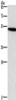 Gel: 8%SDS-PAGE, Lysate: 40 μg, Lane: Human kidney cancer tissue, Primary antibody: CSB-PA039919 (SMAD3 Antibody) at dilution 1/400, Secondary antibody: Goat anti rabbit IgG at 1/8000 dilution, Exposure time: 1 minute