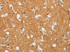 The image on the left is immunohistochemistry of paraffin-embedded Human brain tissue using CSB-PA169656 (SNCA Antibody) at dilution 1/60, on the right is treated with synthetic peptide. (Original magnification: ×200)
