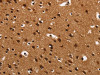 The image on the left is immunohistochemistry of paraffin-embedded Human brain tissue using CSB-PA695075 (ARSB Antibody) at dilution 1/50, on the right is treated with synthetic peptide. (Original magnification: ×200)