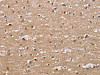 The image on the left is immunohistochemistry of paraffin-embedded Human brain tissue using CSB-PA999579 (ADGRB2 Antibody) at dilution 1/25, on the right is treated with synthetic peptide. (Original magnification: ×200)