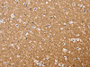 The image on the left is immunohistochemistry of paraffin-embedded Human brain tissue using CSB-PA135204 (BGLAP Antibody) at dilution 1/40, on the right is treated with synthetic peptide. (Original magnification: ×200)