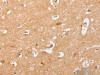 The image on the left is immunohistochemistry of paraffin-embedded Human brain tissue using CSB-PA796533 (BST1 Antibody) at dilution 1/40, on the right is treated with synthetic peptide. (Original magnification: ×200)