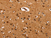 The image on the left is immunohistochemistry of paraffin-embedded Human brain tissue using CSB-PA086010 (CABLES2 Antibody) at dilution 1/25, on the right is treated with synthetic peptide. (Original magnification: ×200)