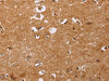 The image on the left is immunohistochemistry of paraffin-embedded Human brain tissue using CSB-PA926996 (CD38 Antibody) at dilution 1/60, on the right is treated with synthetic peptide. (Original magnification: ×200)