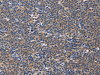 The image on the left is immunohistochemistry of paraffin-embedded Human Lymphoma tissue using CSB-PA563352 (CD5L Antibody) at dilution 1/40, on the right is treated with synthetic peptide. (Original magnification: ×200)