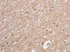 The image on the left is immunohistochemistry of paraffin-embedded Human brain tissue using CSB-PA924477 (CDC34 Antibody) at dilution 1/40, on the right is treated with synthetic peptide. (Original magnification: ×200)