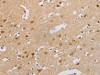 The image on the left is immunohistochemistry of paraffin-embedded Human brain tissue using CSB-PA445592 (CDKN2A Antibody) at dilution 1/60, on the right is treated with synthetic peptide. (Original magnification: ×200)