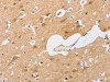 The image on the left is immunohistochemistry of paraffin-embedded Human brain tissue using CSB-PA268568 (CEBPB Antibody) at dilution 1/60, on the right is treated with synthetic peptide. (Original magnification: ×200)