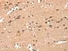 The image on the left is immunohistochemistry of paraffin-embedded Human brain tissue using CSB-PA255746 (CRELD1 Antibody) at dilution 1/40, on the right is treated with synthetic peptide. (Original magnification: ×200)