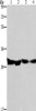 Gel: 8%SDS-PAGE, Lysate: 40 μg, Lane 1-4: Human endometrial carcinoma tissue, Human colon cancer tissue, mouse heart tissue, PC3 cells, Primary antibody: CSB-PA040684 (DECR1 Antibody) at dilution 1/300, Secondary antibody: Goat anti rabbit IgG at 1/8000 dilution, Exposure time: 10 seconds