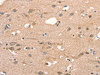 The image on the left is immunohistochemistry of paraffin-embedded Human brain tissue using CSB-PA093388 (DSP Antibody) at dilution 1/15, on the right is treated with synthetic peptide. (Original magnification: ×200)