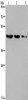 Gel: 8%SDS-PAGE, Lysate: 40 μg, Lane 1-3: Raji cells, human fetal brain tissue, mouse brain tissue, Primary antibody: CSB-PA223936 (ELOVL6 Antibody) at dilution 1/400, Secondary antibody: Goat anti rabbit IgG at 1/8000 dilution, Exposure time: 30 seconds