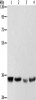 Gel: 8%SDS-PAGE, Lysate: 40 μg, Lane 1-4: Hela cells, hepG2 cells, A549 cells, 293T cells, Primary antibody: CSB-PA181130 (AIMP1 Antibody) at dilution 1/400, Secondary antibody: Goat anti rabbit IgG at 1/8000 dilution, Exposure time: 1 second