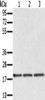Gel: 12%SDS-PAGE, Lysate: 40 μg, Lane 1-3: Jurkat cells, 293T cells, hela cells, Primary antibody: CSB-PA036549 (EPGN Antibody) at dilution 1/150, Secondary antibody: Goat anti rabbit IgG at 1/8000 dilution, Exposure time: 1 minute