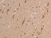 The image on the left is immunohistochemistry of paraffin-embedded Human brain tissue using CSB-PA267720 (ETFB Antibody) at dilution 1/50, on the right is treated with synthetic peptide. (Original magnification: ×200)