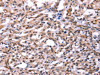 The image on the left is immunohistochemistry of paraffin-embedded Human thyroid cancer tissue using CSB-PA132302 (GCG Antibody) at dilution 1/40, on the right is treated with synthetic peptide. (Original magnification: ×200)