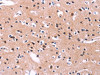 The image on the left is immunohistochemistry of paraffin-embedded Human brain tissue using CSB-PA015132 (PTPN13 Antibody) at dilution 1/20, on the right is treated with synthetic peptide. (Original magnification: ×200) The image on the left is immunohistochemistry of paraffin-embedded Human brain tissue using CSB-PA015132 (PTPN13 Antibody) at dilution 1/20, on the right is treated with synthetic peptide. (Original magnification: ×200)