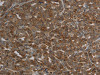 The image on the left is immunohistochemistry of paraffin-embedded Human ovarian cancer tissue using CSB-PA877207 (CFLAR Antibody) at dilution 1/20, on the right is treated with synthetic peptide. (Original magnification: ×200)