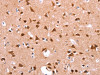 The image on the left is immunohistochemistry of paraffin-embedded Human brain tissue using CSB-PA557036 (FUT8 Antibody) at dilution 1/20, on the right is treated with synthetic peptide. (Original magnification: ×200)