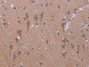 The image on the left is immunohistochemistry of paraffin-embedded Human brain tissue using CSB-PA963807 (KCNJ9 Antibody) at dilution 1/30, on the right is treated with synthetic peptide. (Original magnification: ×200)