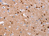 The image on the left is immunohistochemistry of paraffin-embedded Human brain tissue using CSB-PA569512 (GCGR Antibody) at dilution 1/25, on the right is treated with synthetic peptide. (Original magnification: ×200)