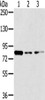 Gel: 6%SDS-PAGE, Lysate: 40 μg, Lane 1-3: A172 cells, 231 cells, Hela cells, Primary antibody: CSB-PA437630 (GPD2 Antibody) at dilution 1/200 dilution, Secondary antibody: Goat anti rabbit IgG at 1/8000 dilution, Exposure time: 30 seconds