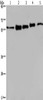 Gel: 6%SDS-PAGE, Lysate: 40 μg, Lane 1-5: MCF7 cells, 293T cells, A549 cells, Hela cells, HepG2 cells, Primary antibody: CSB-PA597489 (HNRNPL Antibody) at dilution 1/450, Secondary antibody: Goat anti rabbit IgG at 1/8000 dilution, Exposure time: 40 seconds