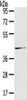 Gel: 8%SDS-PAGE, Lysate: 40 μg, , Primary antibody: CSB-PA569584 (HSD11B2 Antibody) at dilution 1/200 dilution, Secondary antibody: Goat anti rabbit IgG at 1/8000 dilution, Exposure time: 10 seconds