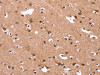 The image on the left is immunohistochemistry of paraffin-embedded Human brain tissue using CSB-PA087383 (HSD17B1 Antibody) at dilution 1/40, on the right is treated with synthetic peptide. (Original magnification: ×200)