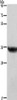 Gel: 8%SDS-PAGE, Lysate: 40 μg, Lane: Human placenta tissue, Primary antibody: CSB-PA087383 (HSD17B1 Antibody) at dilution 1/700, Secondary antibody: Goat anti rabbit IgG at 1/8000 dilution, Exposure time: 1 second