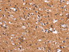 The image on the left is immunohistochemistry of paraffin-embedded Human brain tissue using CSB-PA044365 (HSD17B1 Antibody) at dilution 1/40, on the right is treated with synthetic peptide. (Original magnification: ×200)