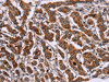 The image on the left is immunohistochemistry of paraffin-embedded Human breast cancer tissue using CSB-PA067380 (ID2 Antibody) at dilution 1/30, on the right is treated with synthetic peptide. (Original magnification: ×200)