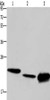 Gel: 10%SDS-PAGE, Lysate: 40 μg, Lane 1-3: Hela cells, mouse liver tissue, Raji cells, Primary antibody: CSB-PA021391 (IL19 Antibody) at dilution 1/550, Secondary antibody: Goat anti rabbit IgG at 1/8000 dilution, Exposure time: 1 minute