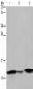 Gel: 10%SDS-PAGE, Lysate: 40 μg, Lane 1-3: Human fetal intestine tissue, mouse colon tissue, Mouse large intestine tissue, Primary antibody: CSB-PA826268 (FABP2 Antibody) at dilution 1/450, Secondary antibody: Goat anti rabbit IgG at 1/8000 dilution, Exposure time: 30 seconds