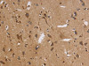 The image on the left is immunohistochemistry of paraffin-embedded Human brain tissue using CSB-PA964497 (ITPR3 Antibody) at dilution 1/30, on the right is treated with synthetic peptide. (Original magnification: ×200)