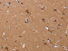 The image on the left is immunohistochemistry of paraffin-embedded Human brain tissue using CSB-PA969766 (JAG1 Antibody) at dilution 1/20, on the right is treated with synthetic peptide. (Original magnification: ×200)