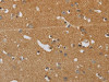 The image on the left is immunohistochemistry of paraffin-embedded Human brain tissue using CSB-PA068103 (KIF4A Antibody) at dilution 1/40, on the right is treated with synthetic peptide. (Original magnification: ×200)