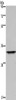 Gel: 10%SDS-PAGE, Lysate: 40 μg, Lane: Mouse thymus tissue, Primary antibody: CSB-PA981207 (ANP32E Antibody) at dilution 1/300, Secondary antibody: Goat anti rabbit IgG at 1/8000 dilution, Exposure time: 20 seconds