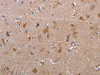 The image on the left is immunohistochemistry of paraffin-embedded Human brain tissue using CSB-PA272625 (MAGEF1 Antibody) at dilution 1/30, on the right is treated with synthetic peptide. (Original magnification: ×200)
