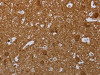 The image on the left is immunohistochemistry of paraffin-embedded Human brain tissue using CSB-PA850358 (MARK1 Antibody) at dilution 1/40, on the right is treated with synthetic peptide. (Original magnification: ×200)