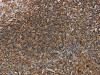 The image on the left is immunohistochemistry of paraffin-embedded Human tonsil tissue using CSB-PA850358 (MARK1 Antibody) at dilution 1/40, on the right is treated with synthetic peptide. (Original magnification: ×200)