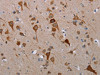 The image on the left is immunohistochemistry of paraffin-embedded Human brain tissue using CSB-PA196650 (MFSD2A Antibody) at dilution 1/25, on the right is treated with synthetic peptide. (Original magnification: ×200)