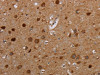 The image on the left is immunohistochemistry of paraffin-embedded Human brain tissue using CSB-PA575736 (MTBP Antibody) at dilution 1/20, on the right is treated with synthetic peptide. (Original magnification: ×200)