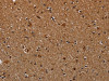 The image on the left is immunohistochemistry of paraffin-embedded Human brain tissue using CSB-PA583070 (NDUFAB1 Antibody) at dilution 1/40, on the right is treated with synthetic peptide. (Original magnification: ×200)
