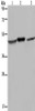 Gel: 8%SDS-PAGE, Lysate: 40 μg, Lane 1-3: Mouse heart tissue, Mouse brain tissue, Jurkat cells, Primary antibody: CSB-PA799827 (NDUFS2 Antibody) at dilution 1/400, Secondary antibody: Goat anti rabbit IgG at 1/8000 dilution, Exposure time: 20 seconds Gel: 8%SDS-PAGE, Lysate: 40 μg, Lane 1-3: Mouse heart tissue, Mouse brain tissue, Jurkat cells, Primary antibody: CSB-PA799827 (NDUFS2 Antibody) at dilution 1/400, Secondary antibody: Goat anti rabbit IgG at 1/8000 dilution, Exposure time: 20 seconds