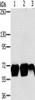 Gel: 6%SDS-PAGE, Lysate: 40 μg, Lane 1-3: K562 cells, Jurkat cells, hepg2 cells, Primary antibody: CSB-PA151401 (MMP9 Antibody) at dilution 1/200, Secondary antibody: Goat anti rabbit IgG at 1/8000 dilution, Exposure time: 1 minute