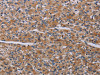The image on the left is immunohistochemistry of paraffin-embedded Human prostate cancer tissue using CSB-PA947926 (PARP4 Antibody) at dilution 1/20, on the right is treated with synthetic peptide. (Original magnification: ×200)